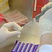 Белорусские специалисты следят за ситуацией вокруг птичьего гриппа H3N8