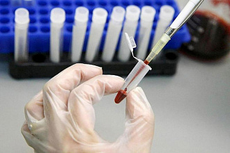 Белорусы могут бесплатно сдать тест на ВИЧ и вирусные гепатиты В и С