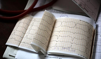 Врач рассказала, почему ревматические болезни могут стать причиной сердечно-сосудистых патологий